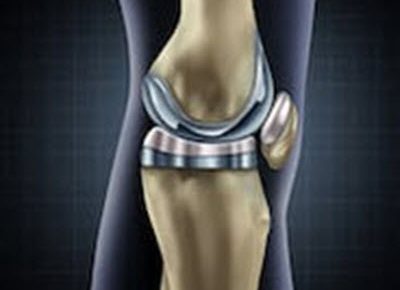 Can Workers’ Compensation Pay For Knee Replacement Surgery In Illinois?