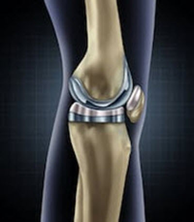 Can Workers’ Compensation Pay For Knee Replacement Surgery In Illinois?