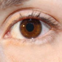 Common Causes Of Workplace Eye Injuries